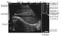 Système diagnostique ultrasonique de Digital de scanner vétérinaire d'ultrason de l'ordinateur portable CLS5800 complètement fournisseur