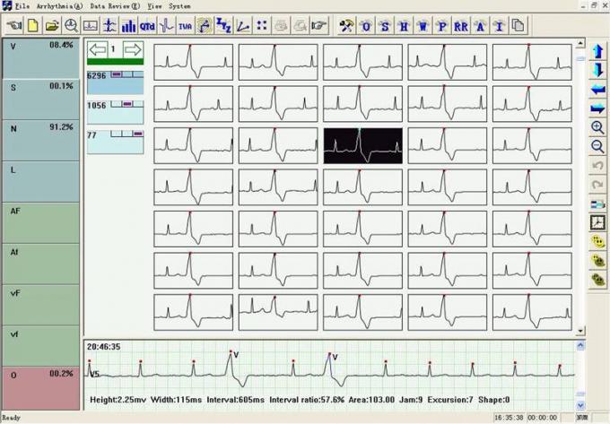Systèmes dynamiques de TLC6000 ECG 12 systèmes de l'avance ECG Holter 48 heures d'enregistreur avec le logiciel d'analyse