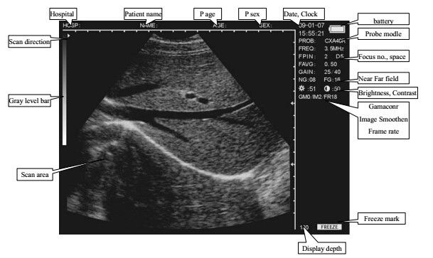 Système diagnostique ultrasonique de Digital de scanner vétérinaire d'ultrason de l'ordinateur portable CLS5800 complètement