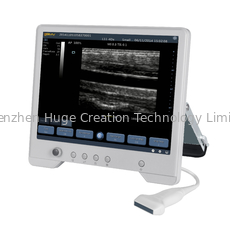 Chine Système diagnostique d'ultrason de TS20 Digital pour le service d'obstétrique et gynécologie fournisseur