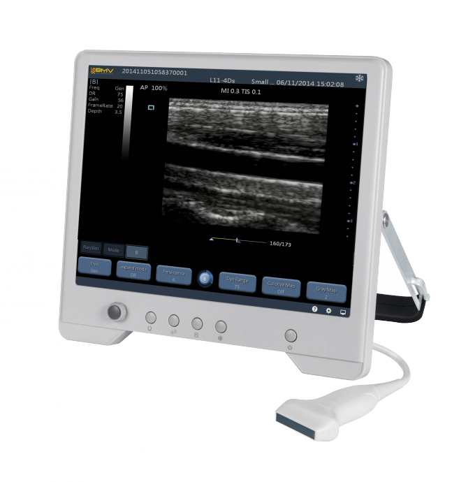 Système diagnostique d'ultrason de TS20 Digital pour le service d'obstétrique et gynécologie